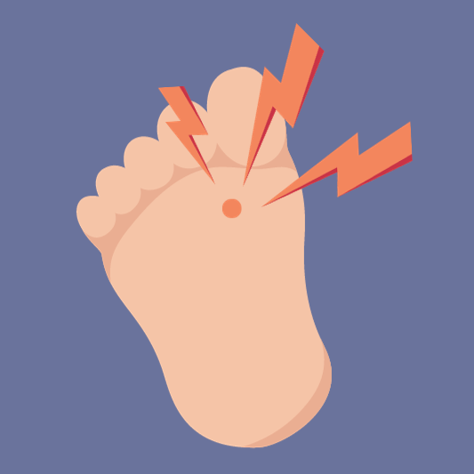 티눈-이미지-예시