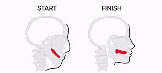 뮤잉(Mewing)이란 무엇이며 어떻게 진행하나요?