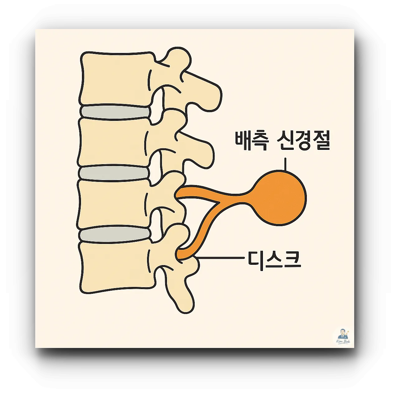 배측신경절과-디스크