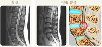 다리 저림 원인 10가지