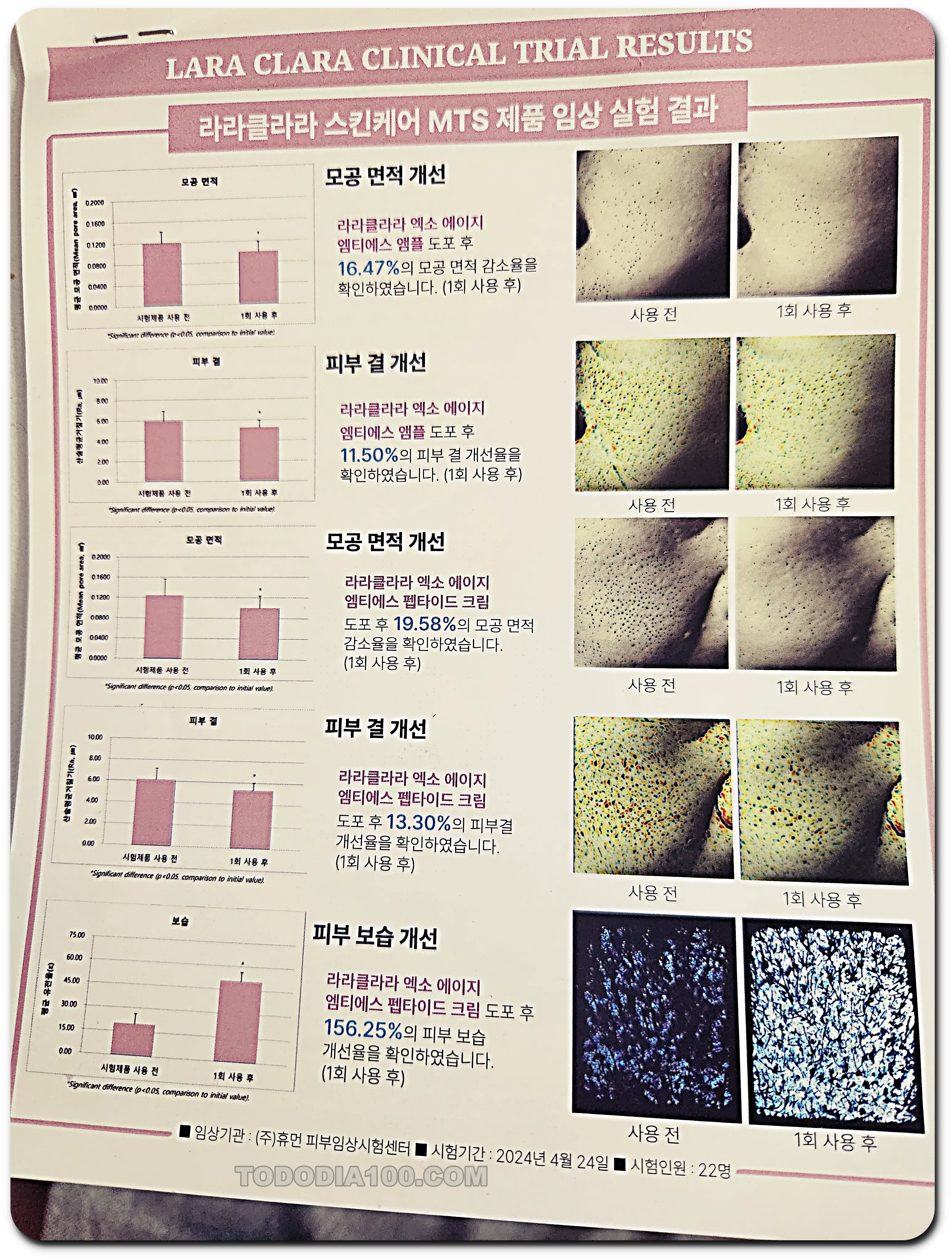 라라클라라-스킨케어-임상결과