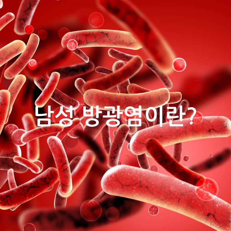 남성 방광염 원인과 증상, 자가치료법