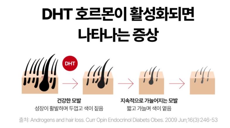 DHT 호르몬이 활성화되면 나타나는 증상