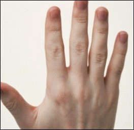 손가락 마디 통증 2