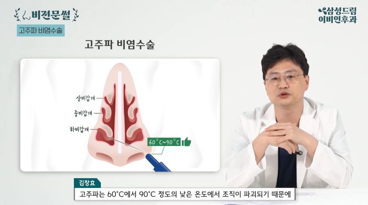 하비갑개 고주파 비염수술