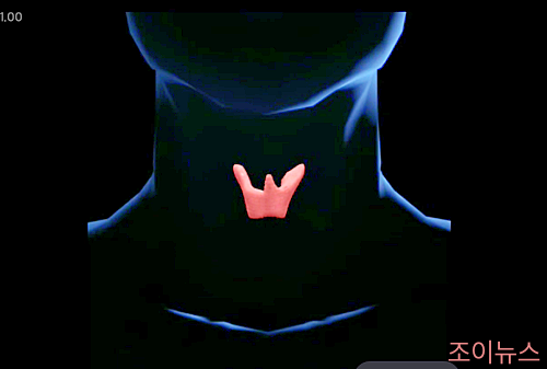 갑상선 기능 검사_ 이미지출처:국가건강정보포털