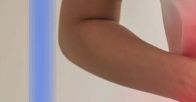 탈장이란, 증세