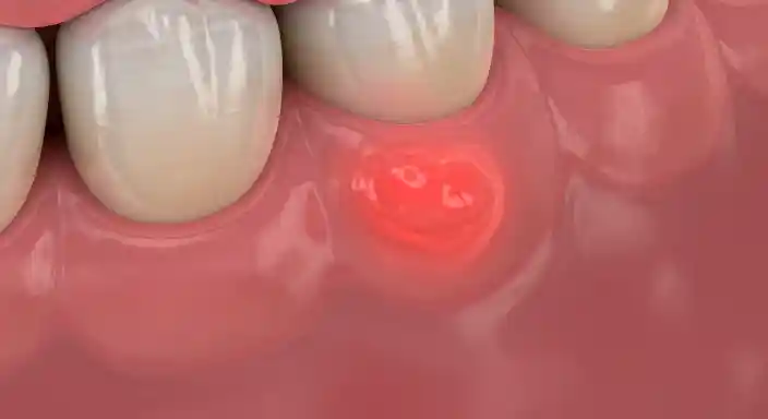 잇몸 부었을 때 대처법