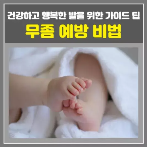 무좀 예방 비법-건강하고 행복한 발을 위한 가이드 팁