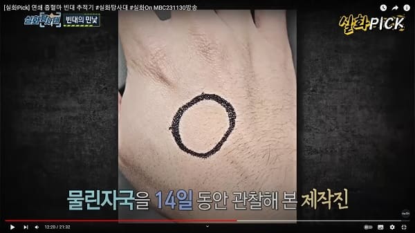 물린 자국을 관찰해보는 실화탐사대 제작진