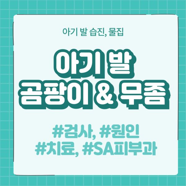 아기 발 곰팡이, 무좀