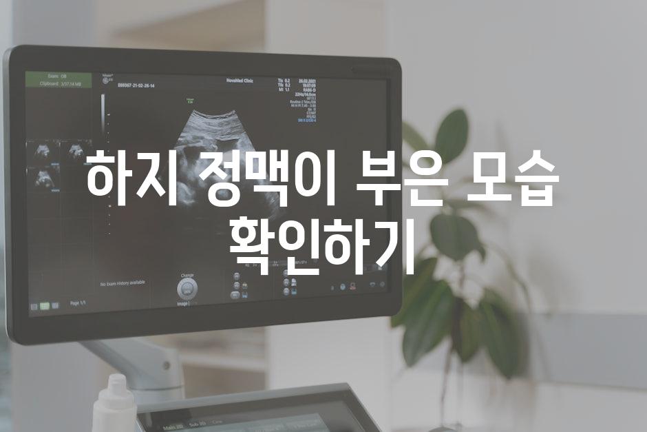 하지 정맥이 부은 모습 확인하기