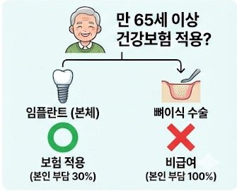 임플란트 건강보험