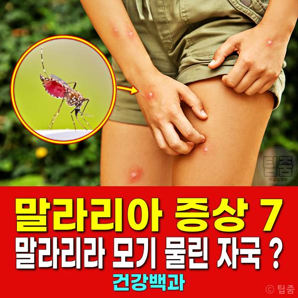 말라리아 증상 원인 말라리아 모기 물린 자국