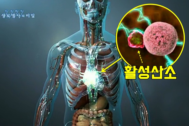 활성산소 심장마비 뇌졸중 동맥경화, 항산화물질, 건강 팁줌 매일꿀정보