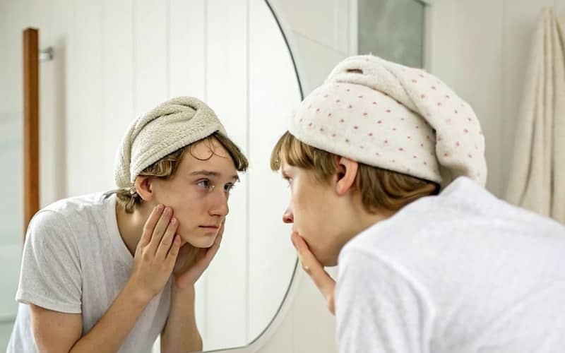 좁쌀 여드름 완벽 제거! 효과 100% 검증된 홈케어 꿀팁