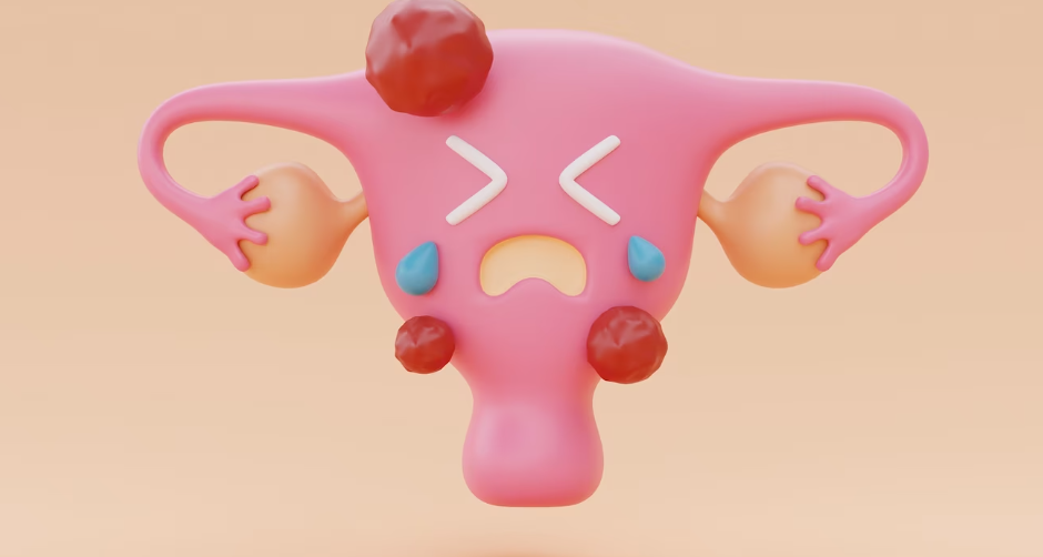 칸디다 질염의 진단