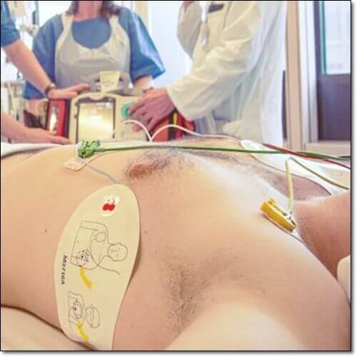 협심증 전조증상, 진단과 치료