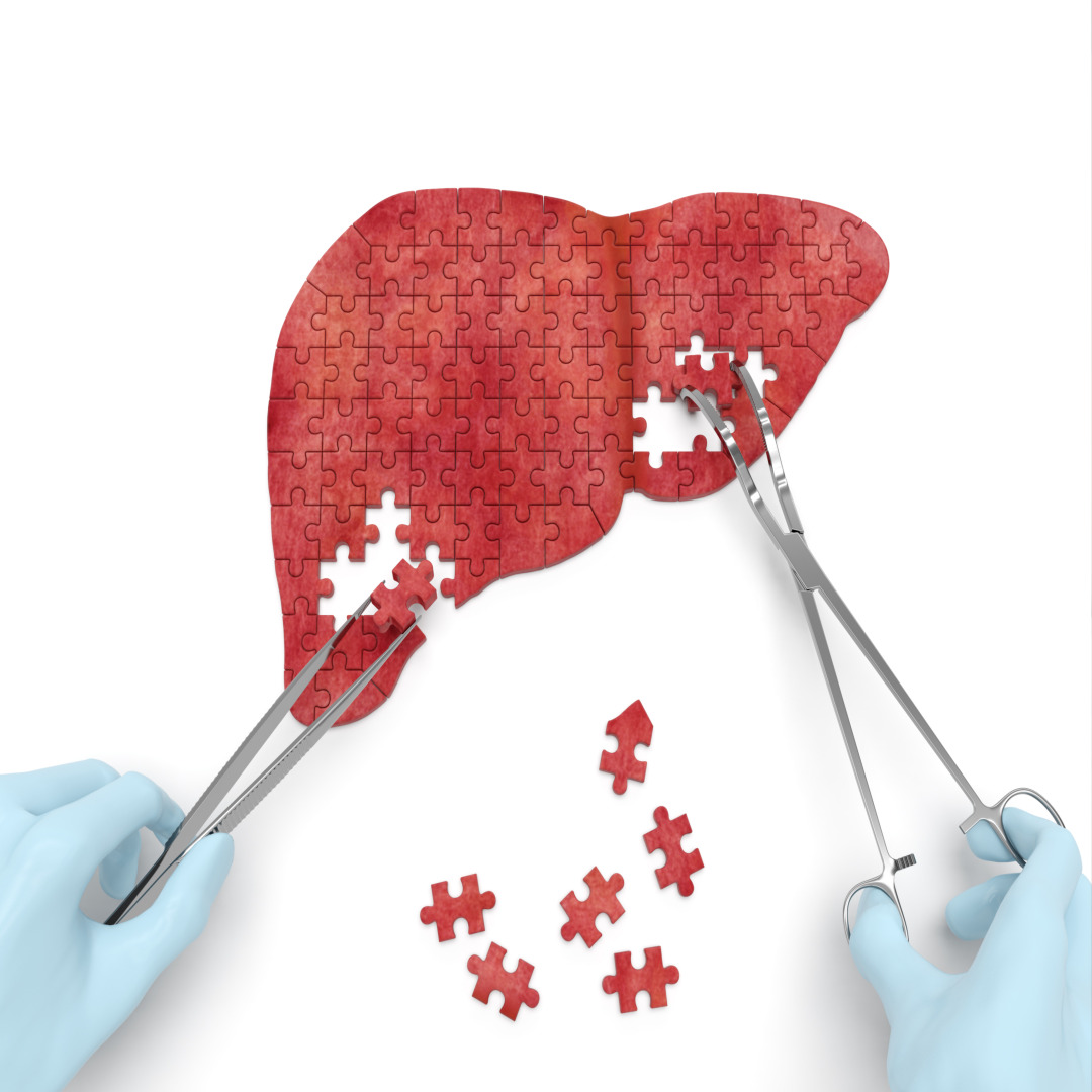 간 건강 적신호 독 되는 음식, 해독법, 간질환