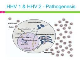 헤르페스 1형과 헤르페스 2형 차이