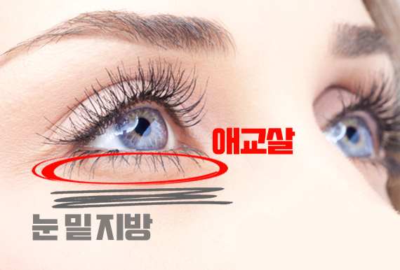 눈-밑-지방과-애교살-차이