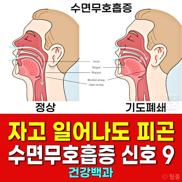 수면무호흡증 자가진단