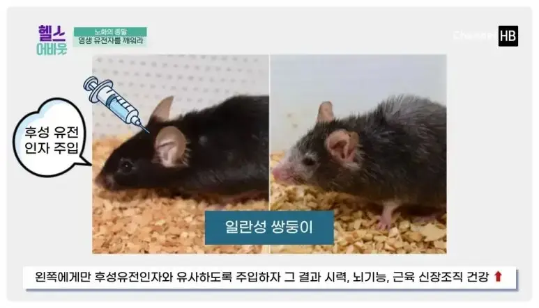 일본nmn효능
