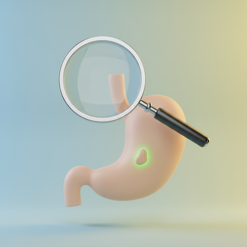 위암&amp;#44; 조기에 발견하면 완치될 수 있다는 사실&amp;#44; 알고 계셨나요?