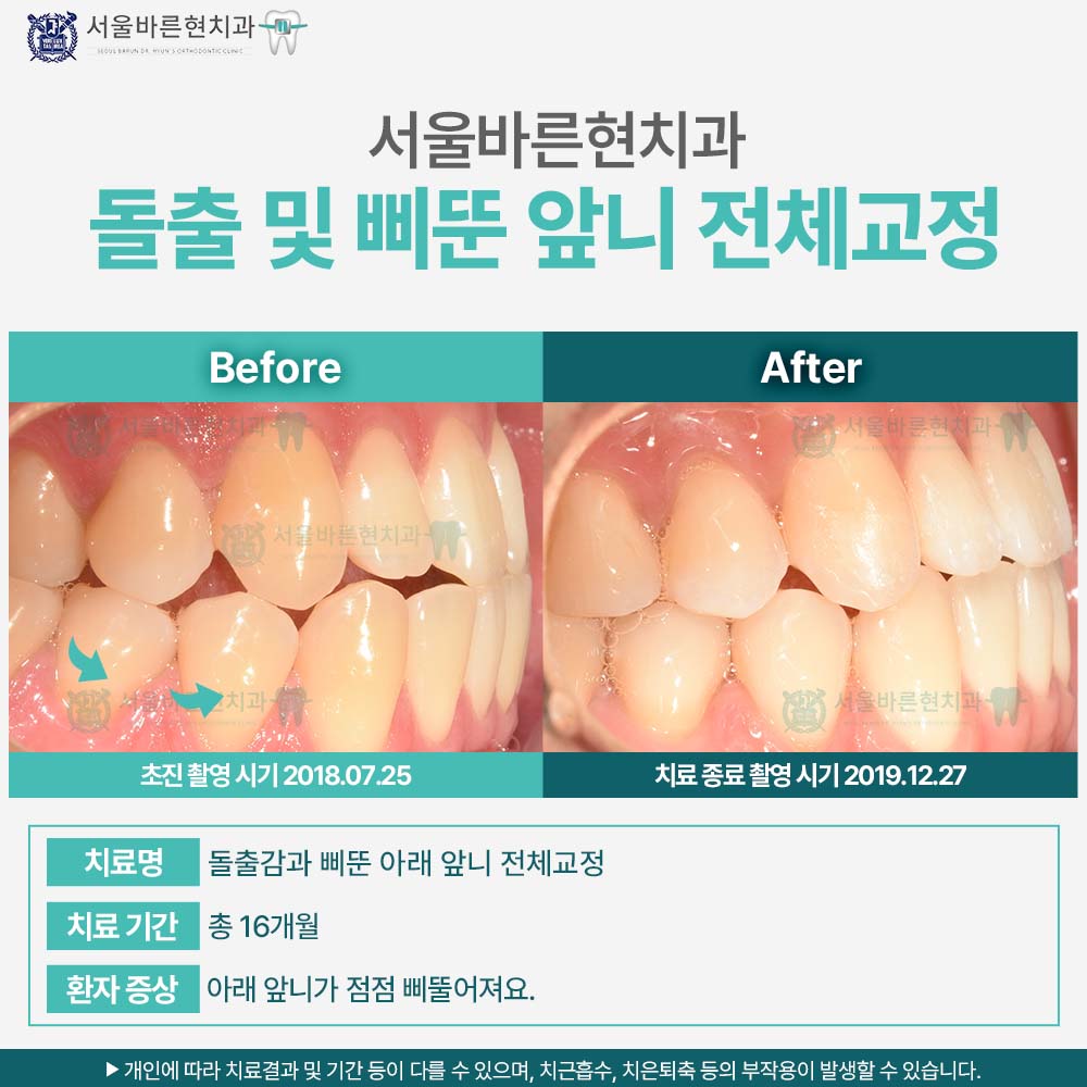 해운대교정치과
