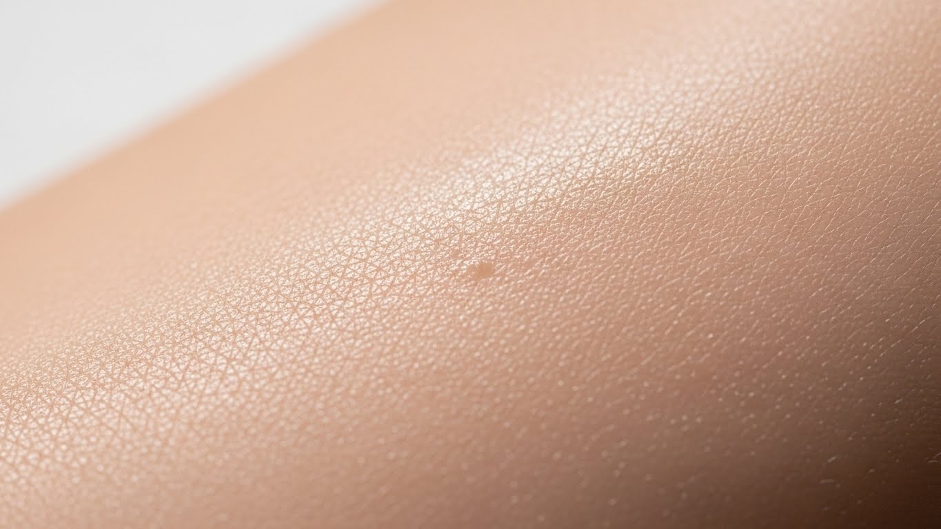 주사후패임&amp;#44; 색소침착관리