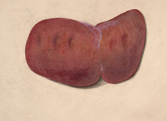 간수치가 높으면 나타나는 증상