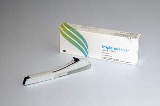 임플라논