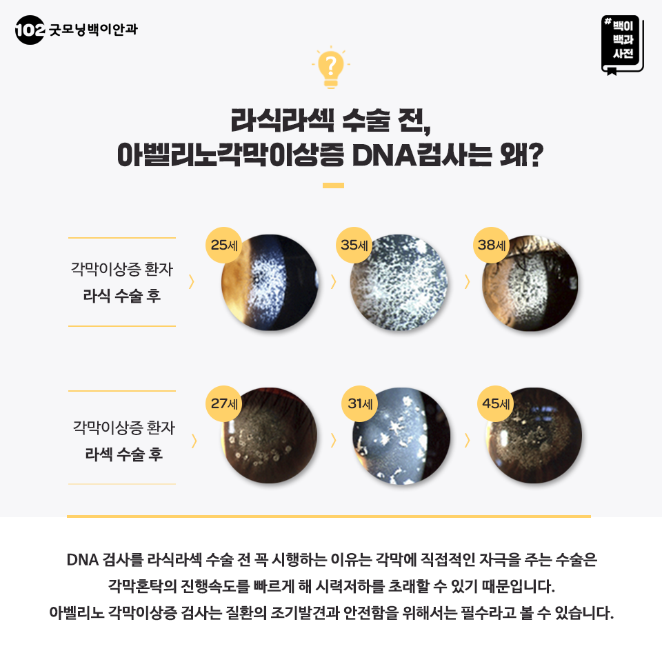 각막혼탁