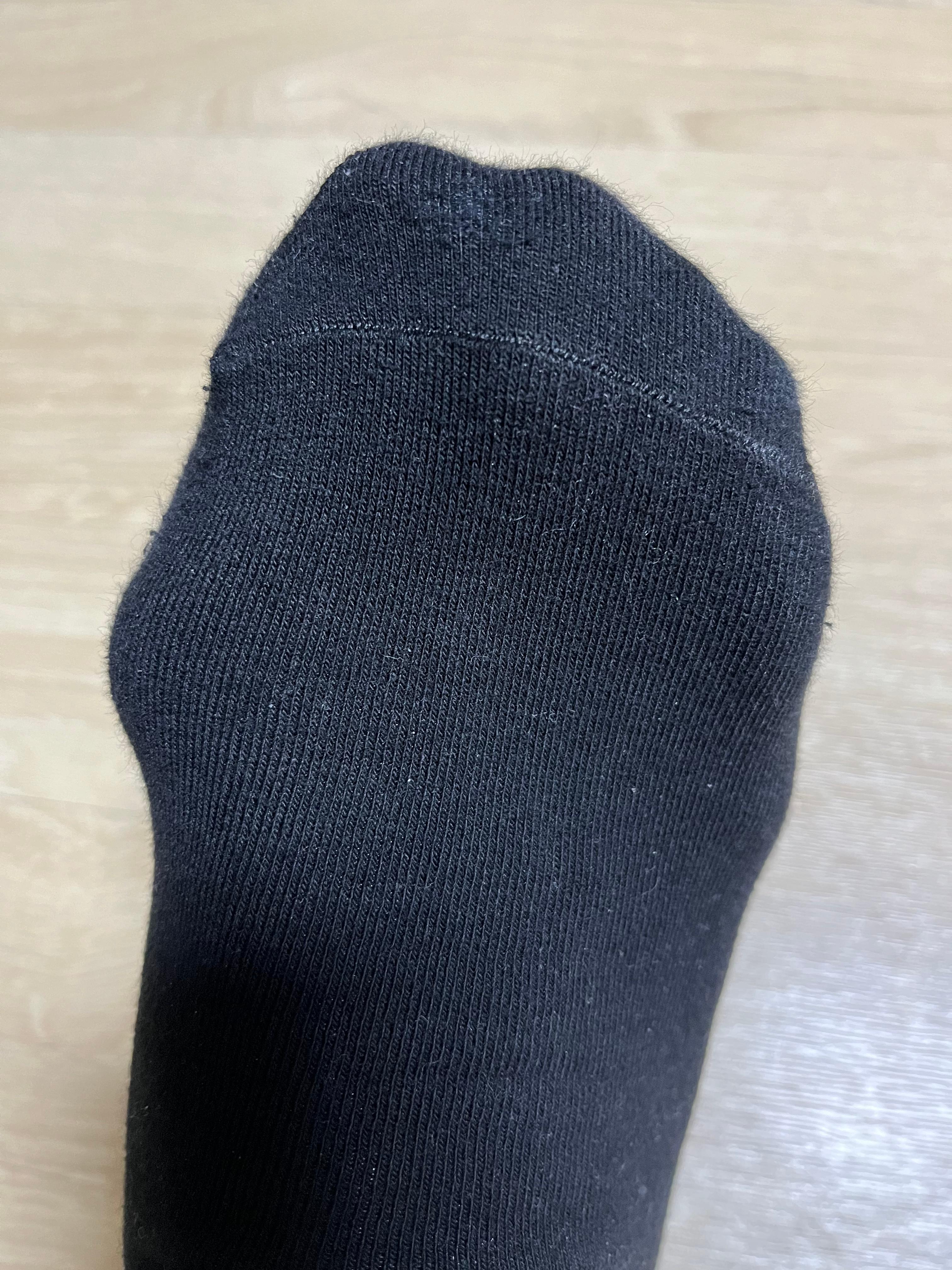 무지외반증 모습-검은 양말 신은 발