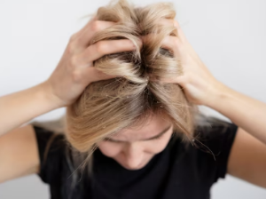 비듬이 생기는 원인