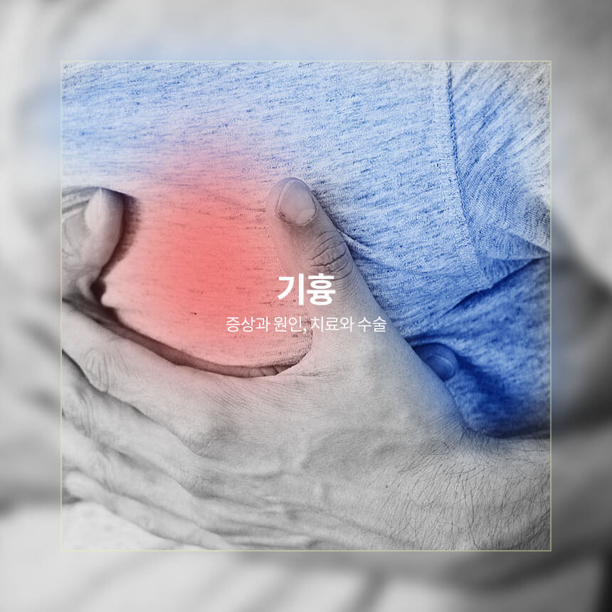 기흉 증상과 원인, 치료와 수술