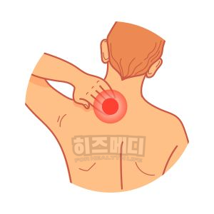 쯔쯔가무시 물린자국