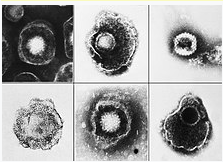 헤르페스바이러스