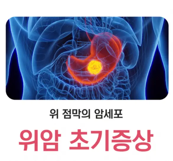 위암-초기증상
