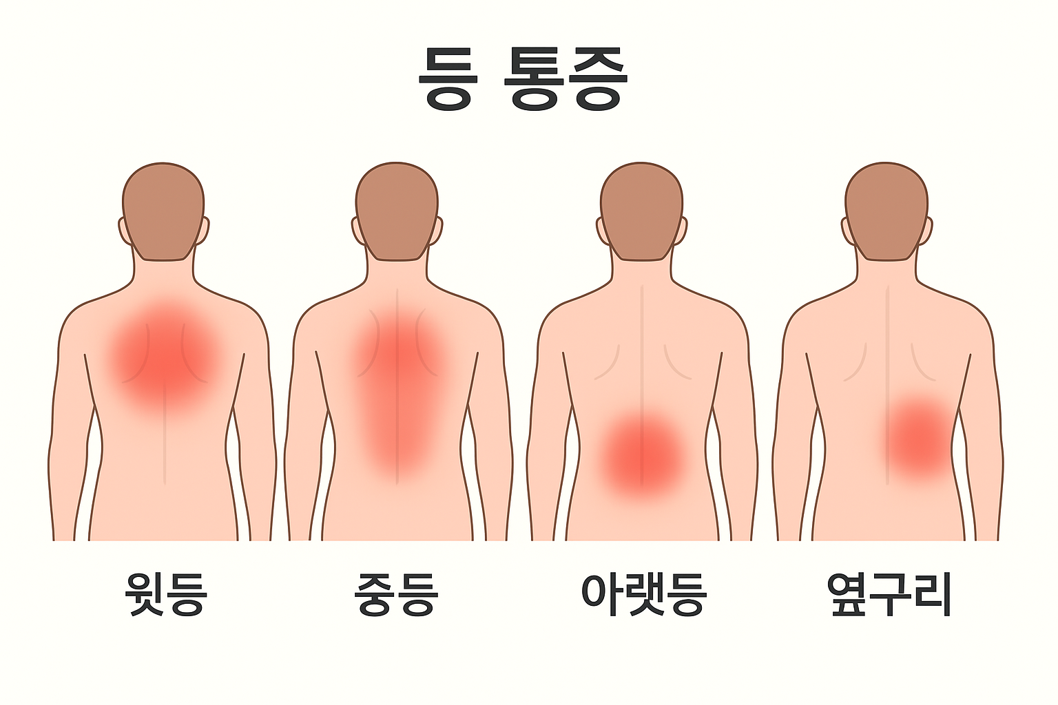 등통증