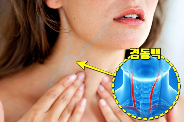 혈관에 좋은 운동,팁줌