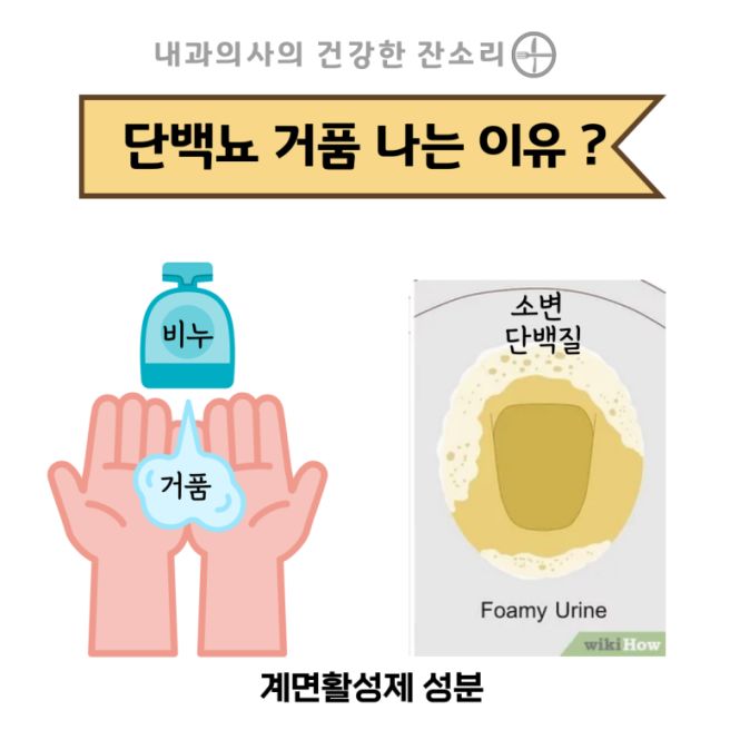 오줌 색깔과 병