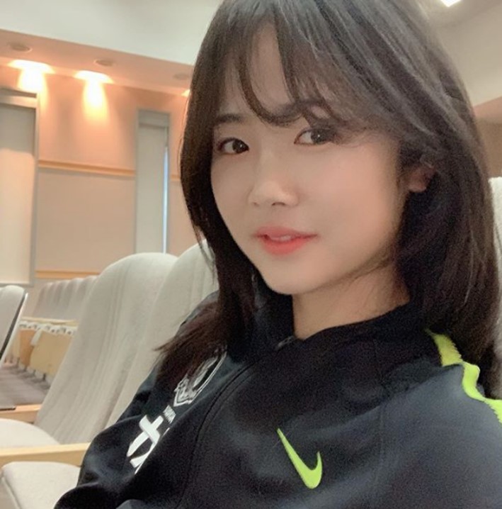 이민아 성형설