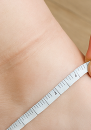 다리 보라색실핏줄