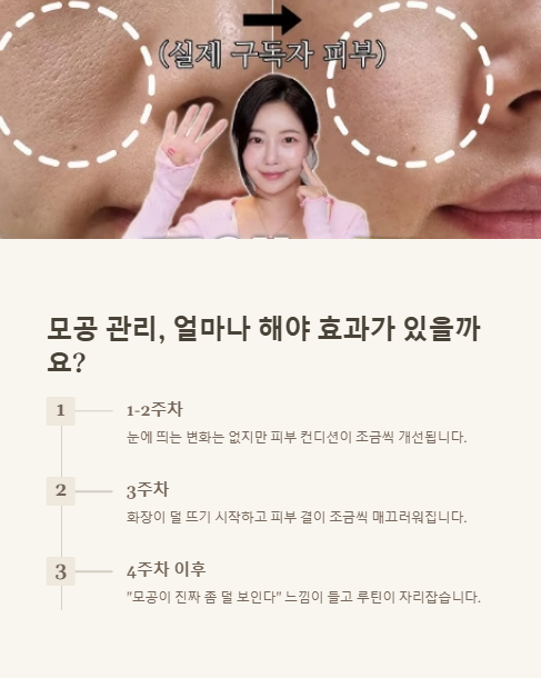 모고 ㅇ관리 얼마나 해야 효과가 있을까요?