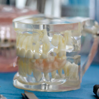 틀니-모형-사진