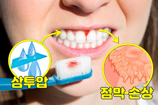 소금 양치 효과 부작용, 팁줌