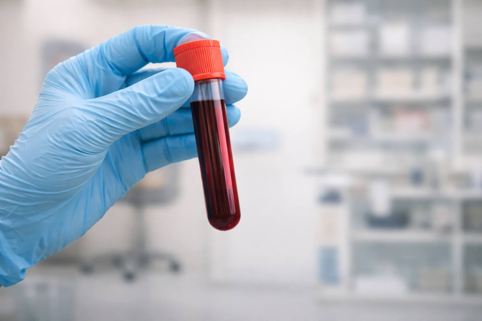 빈혈 증상 자가 체크 7가지와 관리법