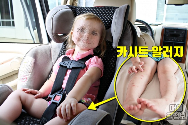 아기 카시트 알러지 아토피