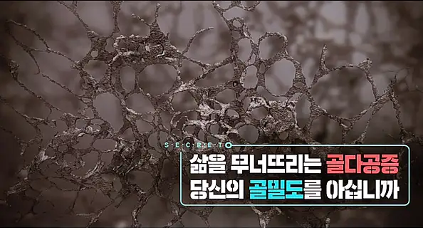 생로병사의 비밀 852회 삶을 무너뜨리는 골다공증 당신의 뼈 건강 척도 골밀도를 아십니까